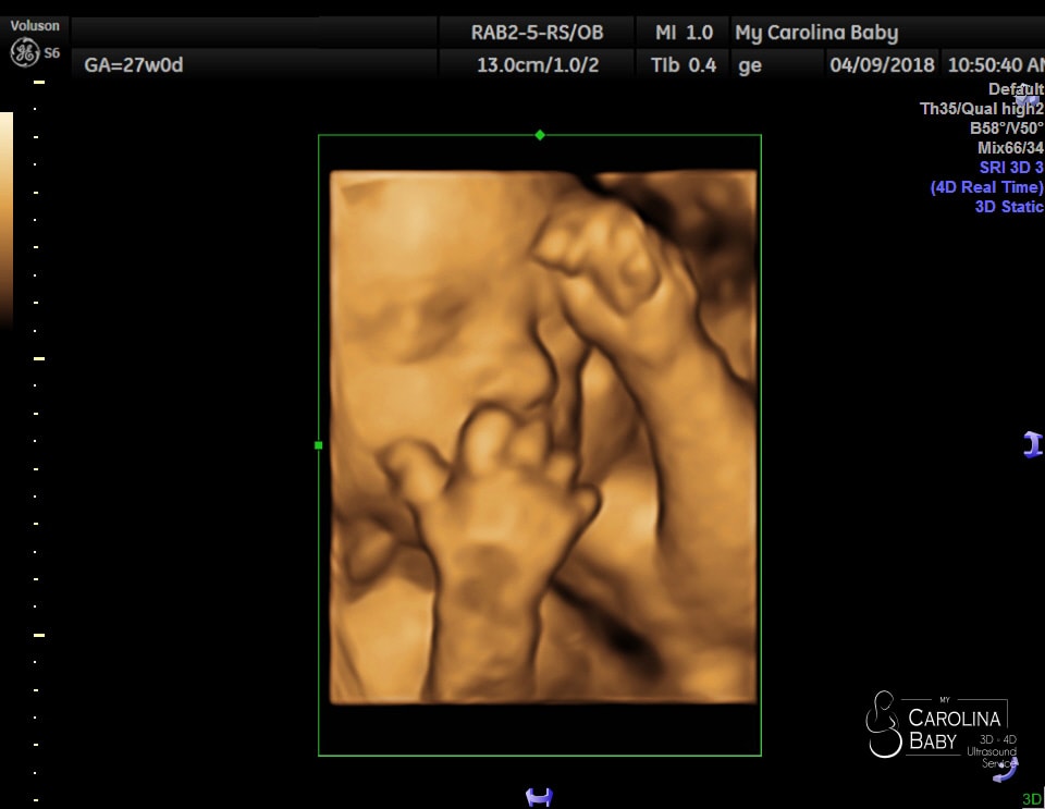 3D / 4D Ultrasound Packages in Charlotte | My Carolina Baby
