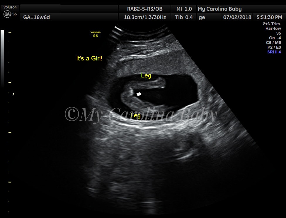 Gender Reveal Ultrasound In Charlotte Nc My Carolina Baby